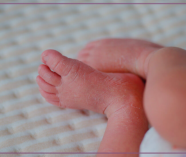 Birth Injuries | BenCoe & LaCour
